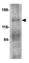 Oviductal Glycoprotein 1 antibody, GTX85381, GeneTex, Western Blot image 