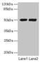 Tubulin Alpha 3e antibody, CSB-PA754255LA01HU, Cusabio, Western Blot image 