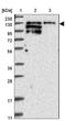 Protein Tyrosine Kinase 2 Beta antibody, NBP1-91228, Novus Biologicals, Immunohistochemistry frozen image 