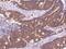 ADP Ribosylation Factor 3 antibody, 107201-T08, Sino Biological, Immunohistochemistry frozen image 