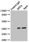 DNA Fragmentation Factor Subunit Alpha antibody, LS-C375596, Lifespan Biosciences, Immunoprecipitation image 