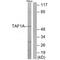 TATA-Box Binding Protein Associated Factor, RNA Polymerase I Subunit A antibody, A11189, Boster Biological Technology, Western Blot image 