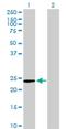 Nicotinamide Riboside Kinase 1 antibody, H00054981-B01P, Novus Biologicals, Western Blot image 