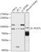 Pseudouridine Synthase 7 Like antibody, 18-098, ProSci, Western Blot image 