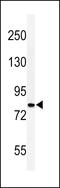 Cadherin-20 antibody, A13390-2, Boster Biological Technology, Western Blot image 