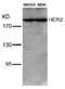 ERBB2 antibody, AP02611PU-N, Origene, Western Blot image 