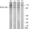 Signal Transducer And Activator Of Transcription 5A antibody, LS-B7582, Lifespan Biosciences, Western Blot image 