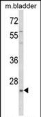 Kruppel Like Factor 16 antibody, PA5-72587, Invitrogen Antibodies, Western Blot image 