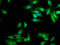Mevalonate Diphosphate Decarboxylase antibody, LS-C670045, Lifespan Biosciences, Immunofluorescence image 