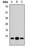 G Protein Subunit Gamma 10 antibody, LS-C667828, Lifespan Biosciences, Western Blot image 