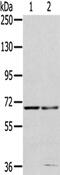 Matrix Metallopeptidase 24 antibody, PA5-51333, Invitrogen Antibodies, Western Blot image 