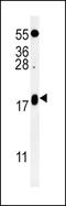 Vesicle Associated Membrane Protein 4 antibody, LS-C160497, Lifespan Biosciences, Western Blot image 