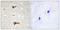 Potassium Voltage-Gated Channel Subfamily A Member 3 antibody, LS-C199179, Lifespan Biosciences, Immunohistochemistry frozen image 