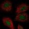 Tsukushi, Small Leucine Rich Proteoglycan antibody, NBP1-87959, Novus Biologicals, Immunocytochemistry image 
