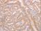 ADAM Metallopeptidase With Thrombospondin Type 1 Motif 10 antibody, LS-C402861, Lifespan Biosciences, Immunohistochemistry frozen image 