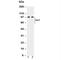 Myelin Associated Glycoprotein antibody, R30844, NSJ Bioreagents, Western Blot image 