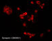 Synapsin I antibody, SM3651, ECM Biosciences, Immunocytochemistry image 