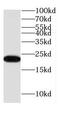 COMM Domain Containing 8 antibody, FNab01852, FineTest, Western Blot image 