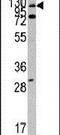 ABL Proto-Oncogene 1, Non-Receptor Tyrosine Kinase antibody, PA5-14761, Invitrogen Antibodies, Western Blot image 