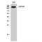 Ubiquitin-specific-processing protease 40 antibody, LS-C386604, Lifespan Biosciences, Western Blot image 