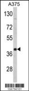 Farnesyltransferase, CAAX Box, Alpha antibody, 61-394, ProSci, Western Blot image 