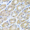 Glucosamine (UDP-N-Acetyl)-2-Epimerase/N-Acetylmannosamine Kinase antibody, A01647-2, Boster Biological Technology, Immunohistochemistry paraffin image 