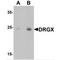 Dorsal Root Ganglia Homeobox antibody, MBS150180, MyBioSource, Western Blot image 