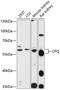 Carboxypeptidase Q antibody, 14-243, ProSci, Western Blot image 