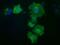 Protein Kinase D2 antibody, GTX83819, GeneTex, Immunocytochemistry image 