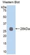 Lysyl Oxidase Like 2 antibody, LS-C373384, Lifespan Biosciences, Western Blot image 