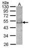 Suppressor of cytokine signaling 4 antibody, TA308763, Origene, Western Blot image 