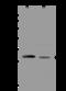 Phosphoserine Phosphatase antibody, 200804-T36, Sino Biological, Western Blot image 