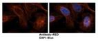 Tubulin Alpha 1c antibody, NBP1-79850, Novus Biologicals, Immunofluorescence image 