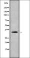 Secretagogin, EF-Hand Calcium Binding Protein antibody, orb336377, Biorbyt, Western Blot image 