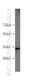 Ribosomal Protein Lateral Stalk Subunit P0 antibody, 51019-2-AP, Proteintech Group, Western Blot image 