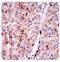 Perilipin 2 antibody, MA5-24797, Invitrogen Antibodies, Immunohistochemistry paraffin image 