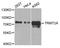 TRNA Methyltransferase 2 Homolog A antibody, A5975, ABclonal Technology, Western Blot image 