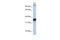 Kinesin Family Member C3 antibody, PA5-40803, Invitrogen Antibodies, Western Blot image 