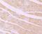 Desmoglein 2 antibody, A02035-2, Boster Biological Technology, Immunohistochemistry paraffin image 