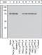 Protein Kinase C Eta antibody, GTX25798, GeneTex, Western Blot image 