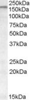 ATP Binding Cassette Subfamily A Member 9 antibody, EB08619, Everest Biotech, Western Blot image 