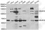 BUB1 Mitotic Checkpoint Serine/Threonine Kinase B antibody, A1775, ABclonal Technology, Western Blot image 