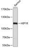 Huntingtin Interacting Protein 1 Related antibody, 19-322, ProSci, Western Blot image 