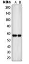 24p3 receptor antibody, orb215170, Biorbyt, Western Blot image 