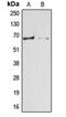 Arylsulfatase E antibody, MBS820965, MyBioSource, Western Blot image 