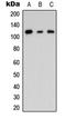 Connector Enhancer Of Kinase Suppressor Of Ras 2 antibody, LS-C354619, Lifespan Biosciences, Western Blot image 
