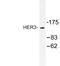 Erb-B2 Receptor Tyrosine Kinase 3 antibody, LS-C177110, Lifespan Biosciences, Western Blot image 