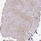 Tripartite Motif Containing 14 antibody, HPA053217, Atlas Antibodies, Immunohistochemistry paraffin image 