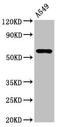Interleukin 1 Receptor Type 1 antibody, LS-C678313, Lifespan Biosciences, Western Blot image 