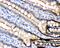 Cadherin 1 antibody, PB9561, Boster Biological Technology, Immunohistochemistry paraffin image 
